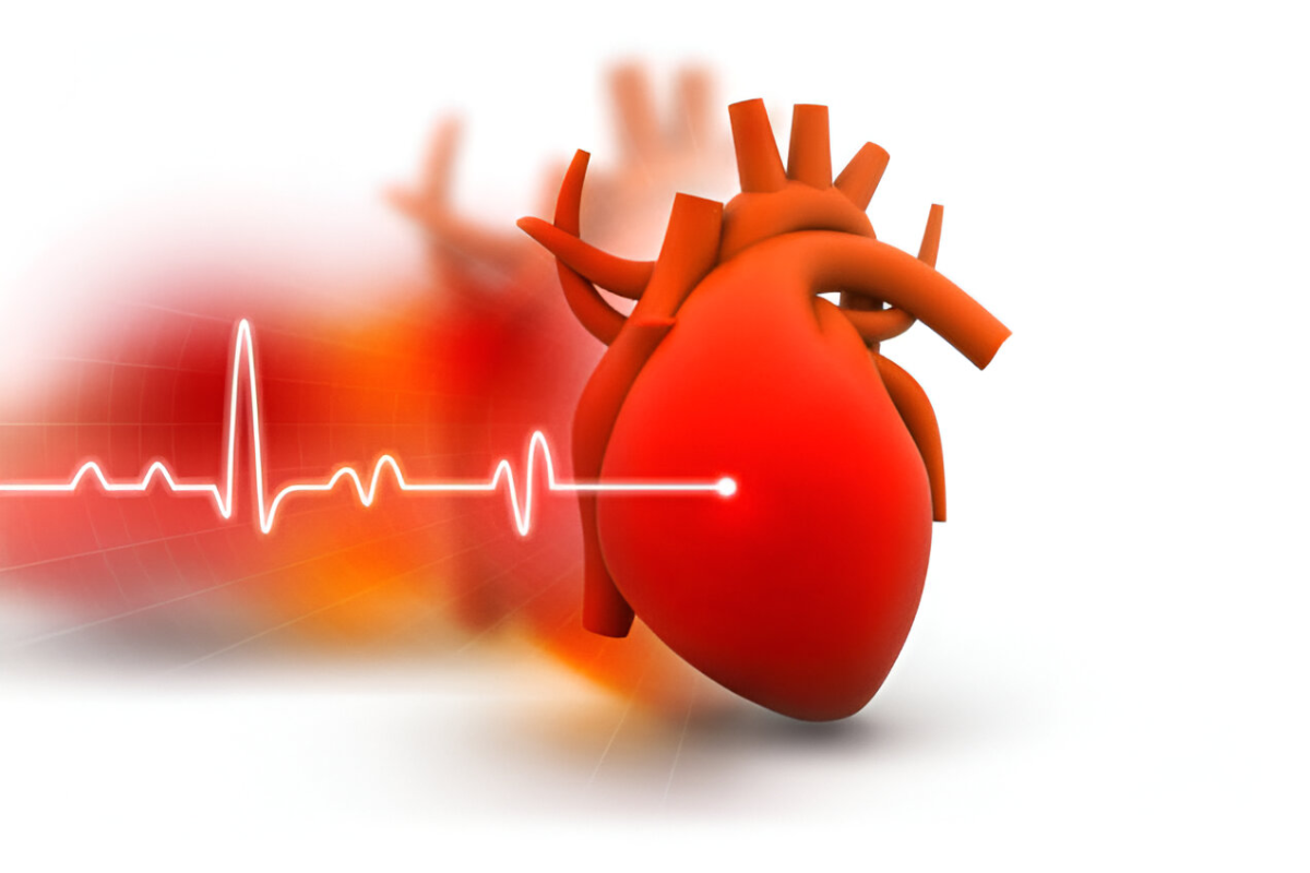 Understanding Arrhythmia