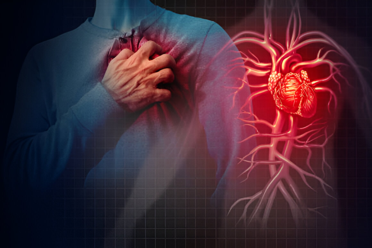 Heart Failure: A Comprehensive Visual Guide to the Condition