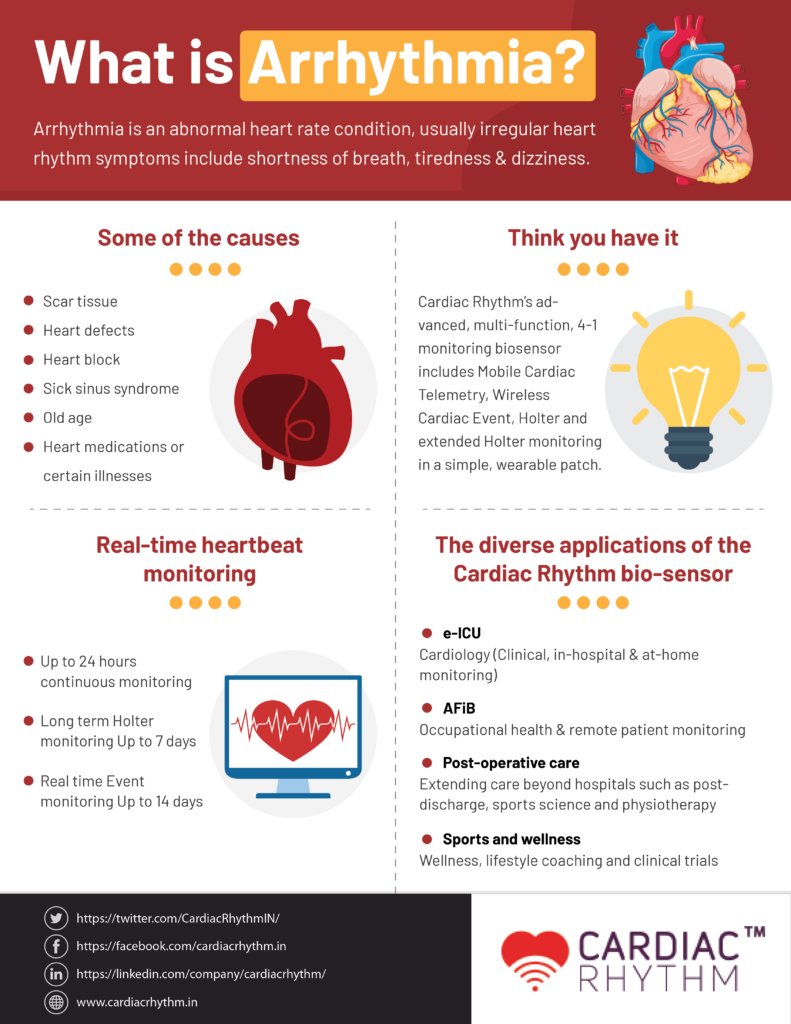 What is an Arrhythmia